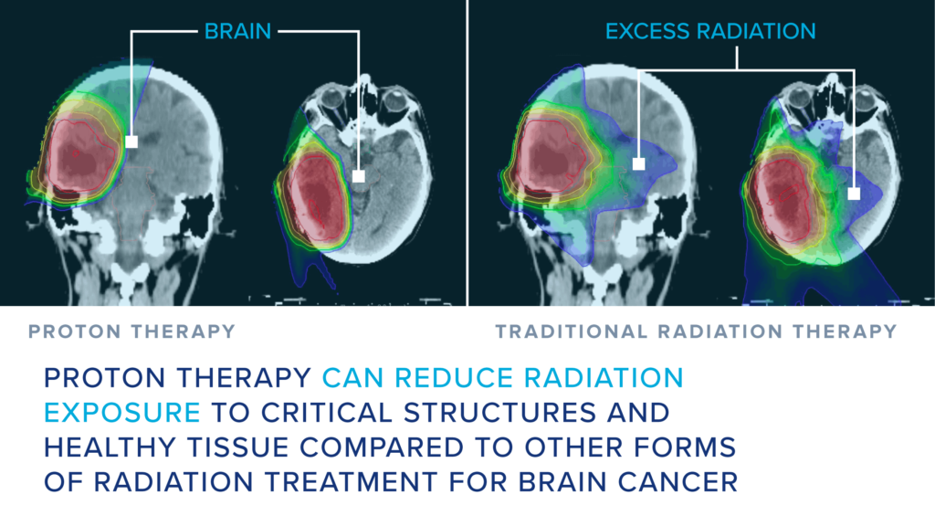 Brain-CNS-Graphic